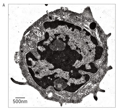 Fig A: This electron microscope image depicts a mucosal mast cell (MMC9).